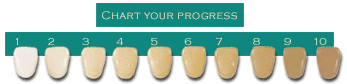 Professional teeth whitening shade chart showing progression from yellow to bright white